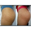 Crema Corporal Anticelulitis Y Estrías Reafirmante 300ml Neutra