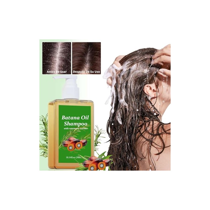 Batana Oil Shampoo, Batana Shampoo with Rosemary Extract, Champú De