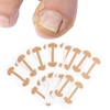 Pack of 30 Ingrown Correction Stickers, Toenail Correction Patch, Ingrown