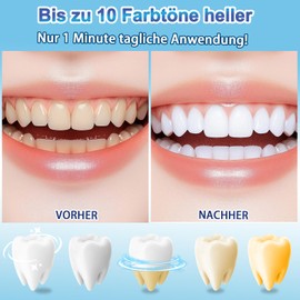 4 Stück Zahnaufhellungsstift, professionelles Zahnaufhellungsgel, Zahnaufhellungs-Set für weiße und glänzende Zähne