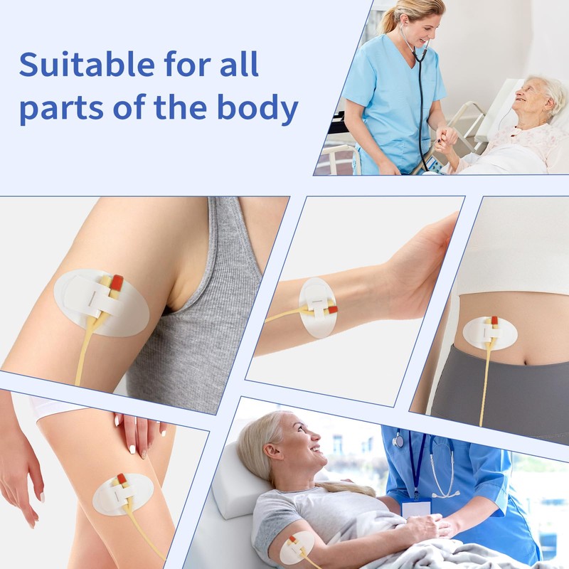 30 PCS Catheter Stabilization Devices, Foley Catheter Supplies Device Sticker,