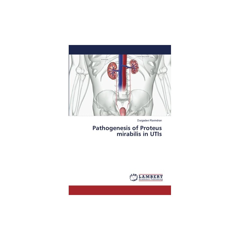 Pathogenesis of Proteus mirabilis in UTIs