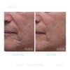 Dr. Denese Collagen Firming Peel Off Mask | 4 FL