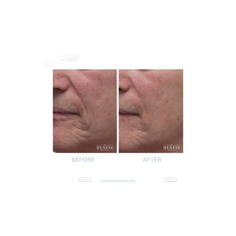 Dr. Denese Collagen Firming Peel Off Mask | 4 FL