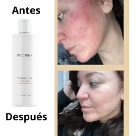 Tónico Facial Caléndula Farmasi Dr C Tuna Piel Seca/sensible
