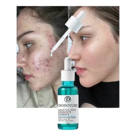 Sérum Ácido Salicílico Antiacné 30ml Repara Hoyos De Acné