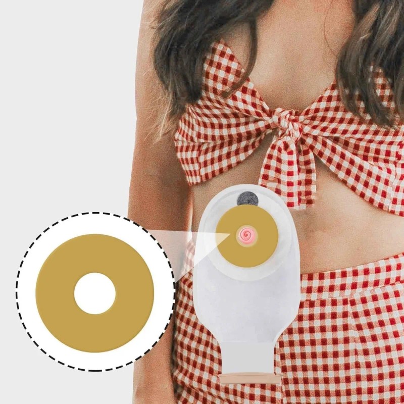 20pzas 4mm Anillo Barrera Para Ostomía 50mm