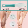 1 ALAZCO Double Sided Foot File Pumice Ergonomic Handle Scrubber