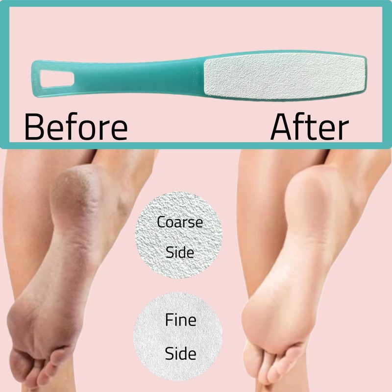 1 ALAZCO Double Sided Foot File Pumice Ergonomic Handle Scrubber