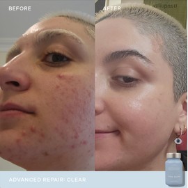 Vida Glow Clear Advanced Repair- 30 Capsules