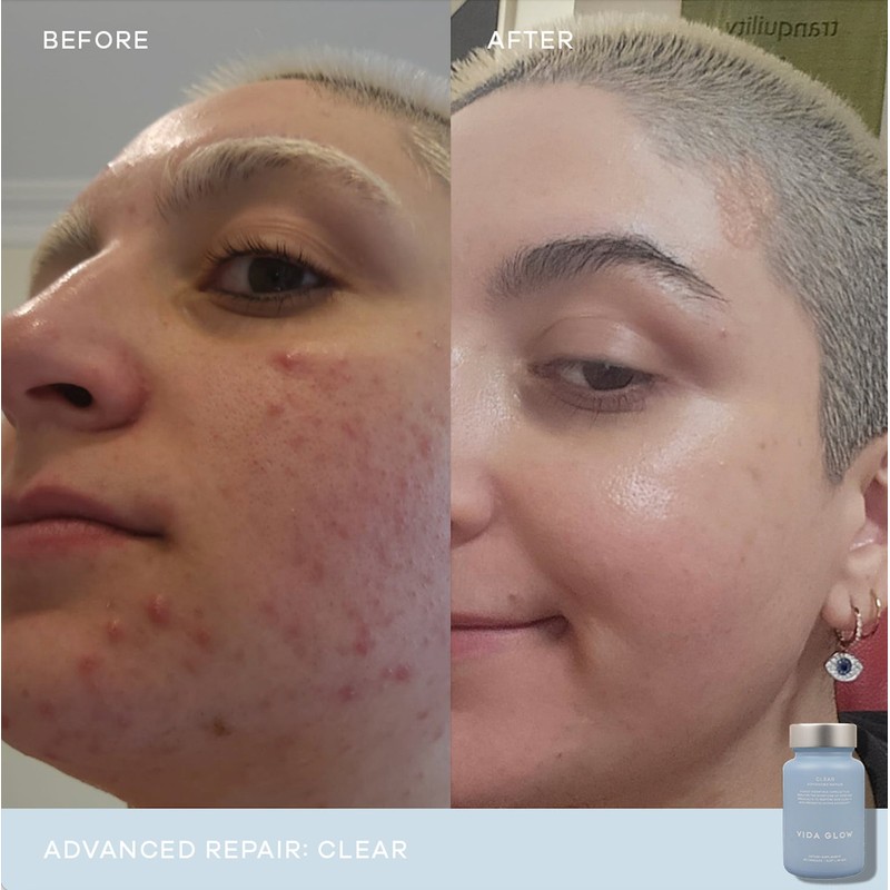 Vida Glow Clear Advanced Repair- 30 Capsules