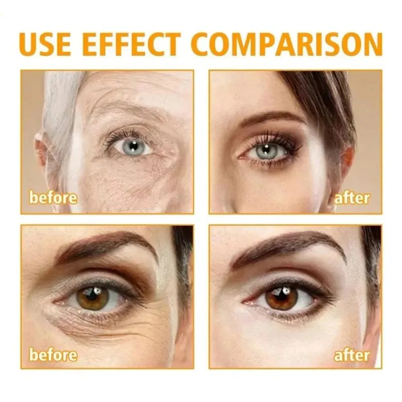Crema Reafirmante Para Ojos, Elimina Bolsas Y Ojeras.