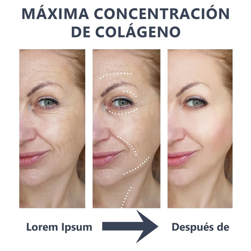 Mascarilla Bio Colágeno: Mascarilla de ColáGeno-Mascarilla Colageno para Minimiza