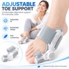 Adjustable Toe Alignment Corrector for Daily Foot Support – Soft