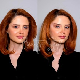 Lift ‘Em Up Facelift Tapes, 20 Pcs USA-Made Hypoallergenic Tapes for Eye Lifting, Instant Face and Eye Lift, Non Surgical Facelift, Waterproof Invisible Facelift Bands (Light)