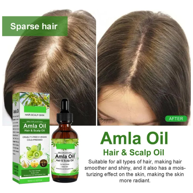 Mzl Aceite Capilar Amla Oil For Crecimiento Cabello
