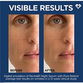 L'Oreal Paris Revitalift Derm Intensives Night Serum, suero de retinol para rostro, 0.3% de retinol puro, reduce visiblemente las arrugas, incluso las