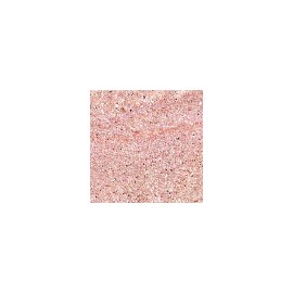 Holika Holika Eye Metal Glitter  - #11 Sweet Heart