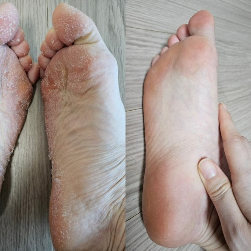 페로린 발팩장인 페로린 로즈향 2회분 1개 뒤꿈치갈라짐 각질제거 필링팩 발바닥