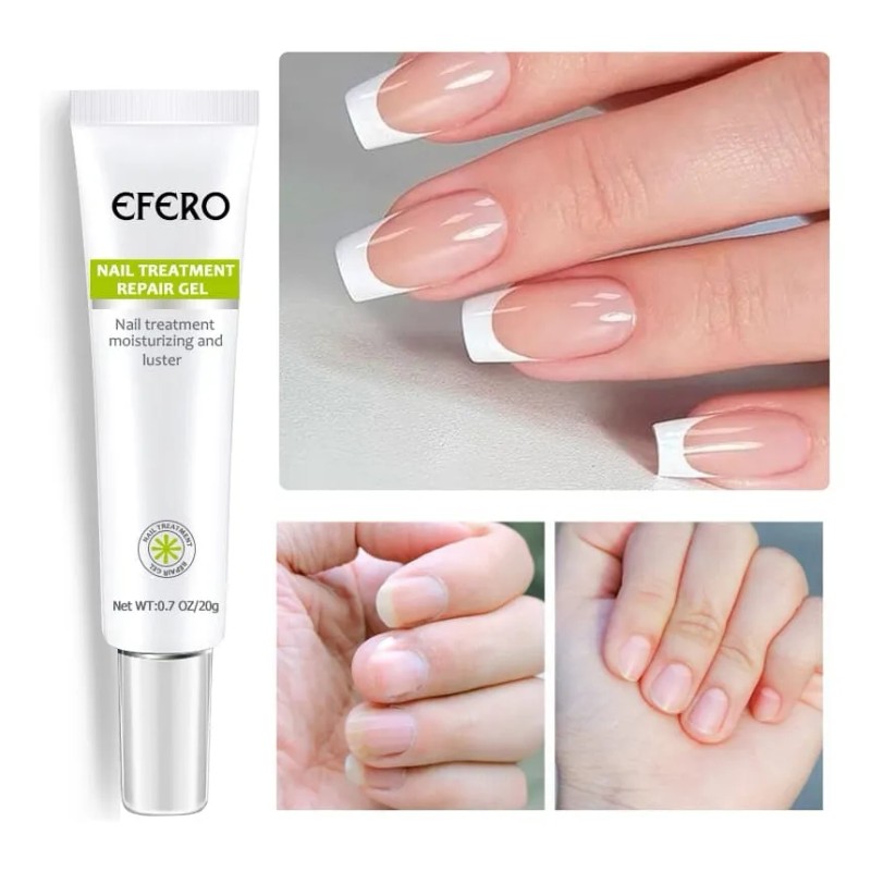 Gel Antihongo Tratamiento Reparador De Uñas Efero 2 Piezas