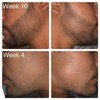 MKKENLEY Best Beard Growth Oil Serum Fast Promote Thick Beard