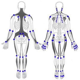 SELFnobb - 4-head massager, self-massage for back, neck, shoulder, feet, thumb and much more - universally applicable, trigger point massage at home, in the office or on the go (blue)