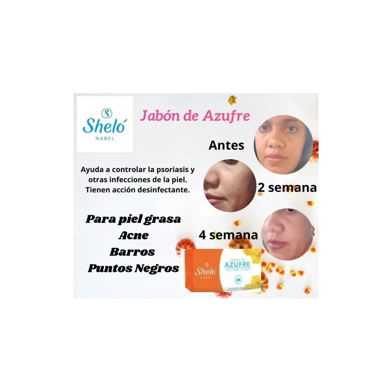 10 Jabón Azufre + Carbón Activado Para Acné & Puntos