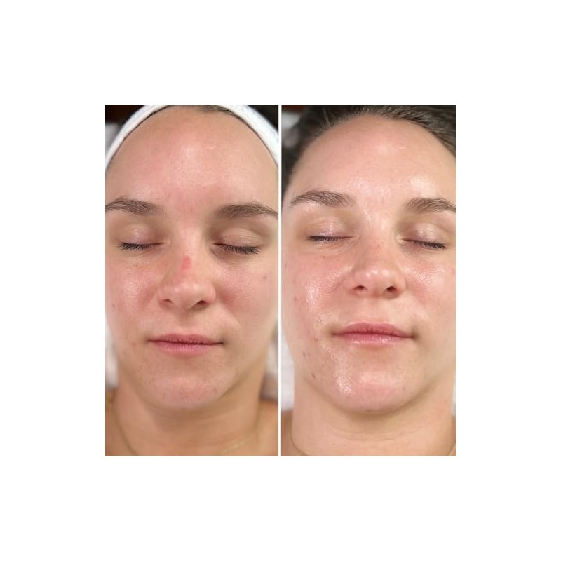 Intraceuticals Vitamin D3+ Booster