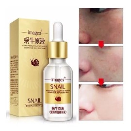 Serum Original Cierra Poros Puntos Negros Piel Grasa Acné Normal