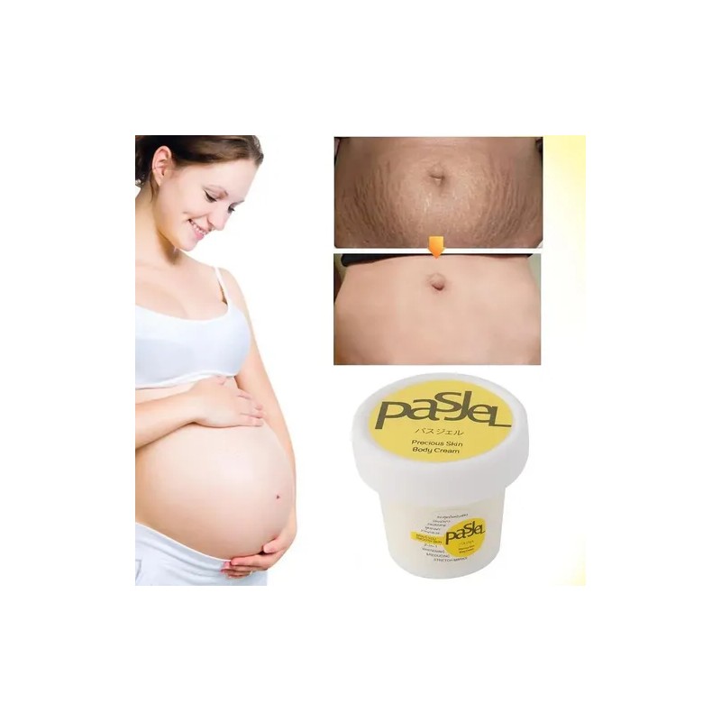 Creme Remoção De Reparação Mulher Grávida Estrias 2pcs