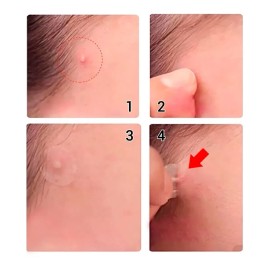 Parches Dia/ Noche Quita