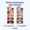 DrDent Professional LED Gel Pen Teeth Whitening Sensitive Formula 30+