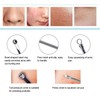 Blackhead Removal Rechargeable 5 Adjustable Suction Electric Pore Acne Cleaner