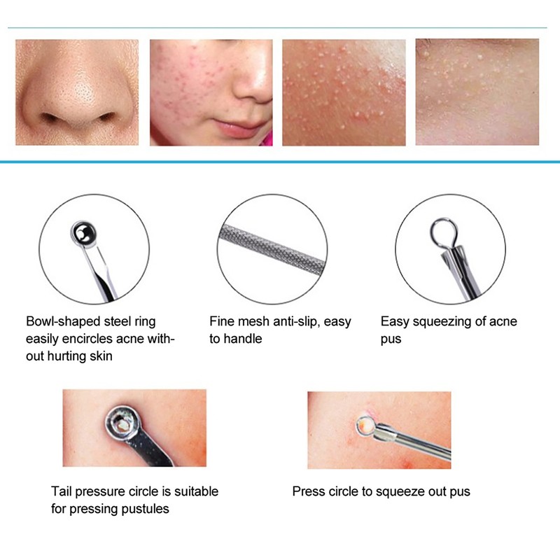 Blackhead Removal Rechargeable 5 Adjustable Suction Electric Pore Acne Cleaner