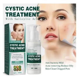 Jay Cystic Acne Tratamiento Para Eliminar Espinillas Barros Momento De Aplicación Día/noche Tipo De Piel Mixta