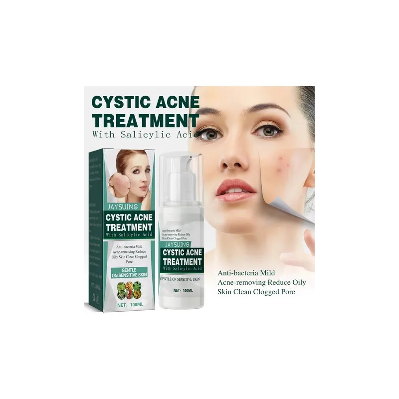 Jay Cystic Acne Tratamiento Para Eliminar Espinillas Barros Momento De