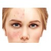 exfoliante de bamboo activado Exoliante Carbon Bamboo Acido Hialuronico Natural
