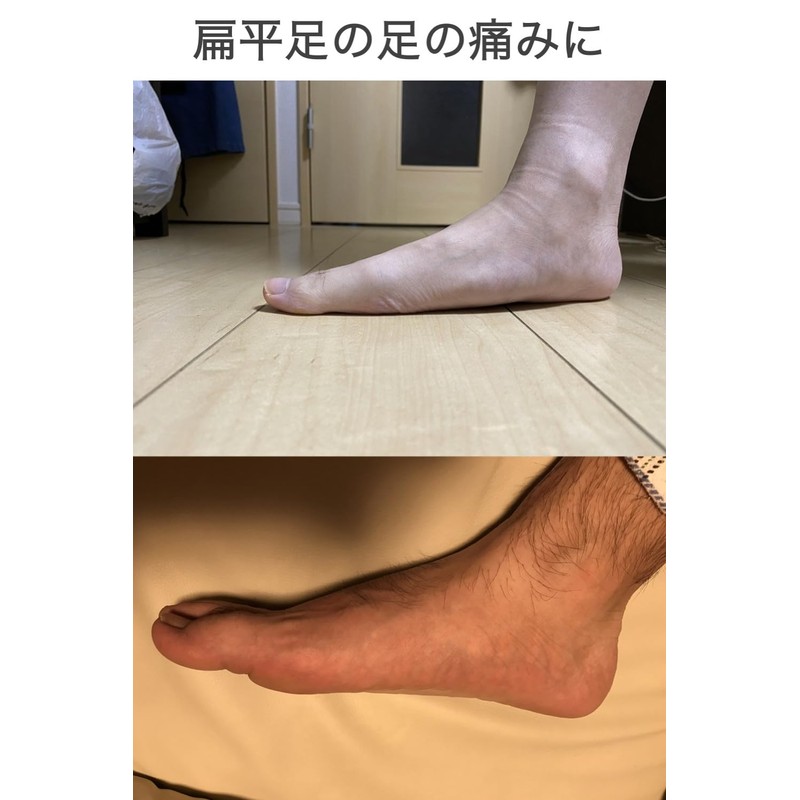 wumio 扁平足 アーチサポーター 1組(2個)セット シリコン 偏平足サポーター 土踏まずサポーター 足底筋膜炎 男女兼用 調整可能