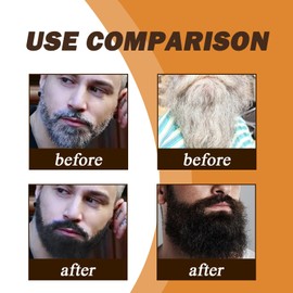 Rostblant Bart Verdunkelung Shampoo,Natural Hair Dye, Instant Hair Shampoo Haarfarbe, Schwarzes Haarfärbe shampoo, Reinigender Bart