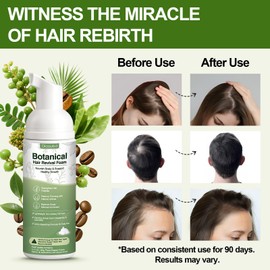 Hair Growth Oil Foam with Rosemary and Castor Oil Vegan Natural Formula for Thinning Hair Organic Plant Based Scalp Treatment Non Greasy Hair Regrowth Support for Men and Women 3 Bottles Each 2.11 oz