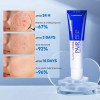 Lion Pair Acne Cream W Original Crema Antiacné Japonesa 14g