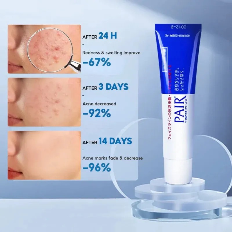 Lion Pair Acne Cream W Original Crema Antiacné Japonesa 14g