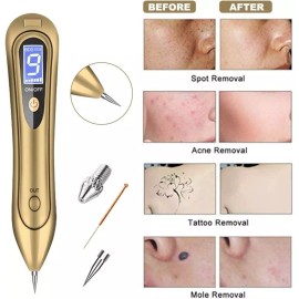Cauterizador Quita Manchas Pecas Verrugas Tatuajes Con Luces