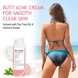 Butt Acne Cream 100ml, Butt Acne Treatment for Women with Tea Tree Oil, Body Acne Lotion for Back and Thighs, Acne Scar Cream and Pimple Spot Treatment for Smooth Clear Skin