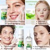 Aloe Vera Skin Care Set Gifts for Women - Skincare