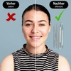 com-four Blackhead Remover Set - 5 Piece Stainless Steel Facial