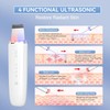 ANLAN Peeling Ultrasonico Facial, Skin Scrubber, Espatula Ultrasonica Facial, Ultrasonico