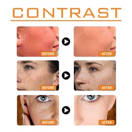 Sunscreen SPF 100, Waterproof Moisturiser with SPF 100,UVB/UVA Protection Sun Cream,Waterproof Sunscreen,Sun Cream for Face Women,Non-Greasy SPF100 Sun/screen Lotion for Daily Use,Hydrating Sun/screen