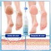 Foot Callus Remover Gel Extra Strength 6 oz – GIVOOBE