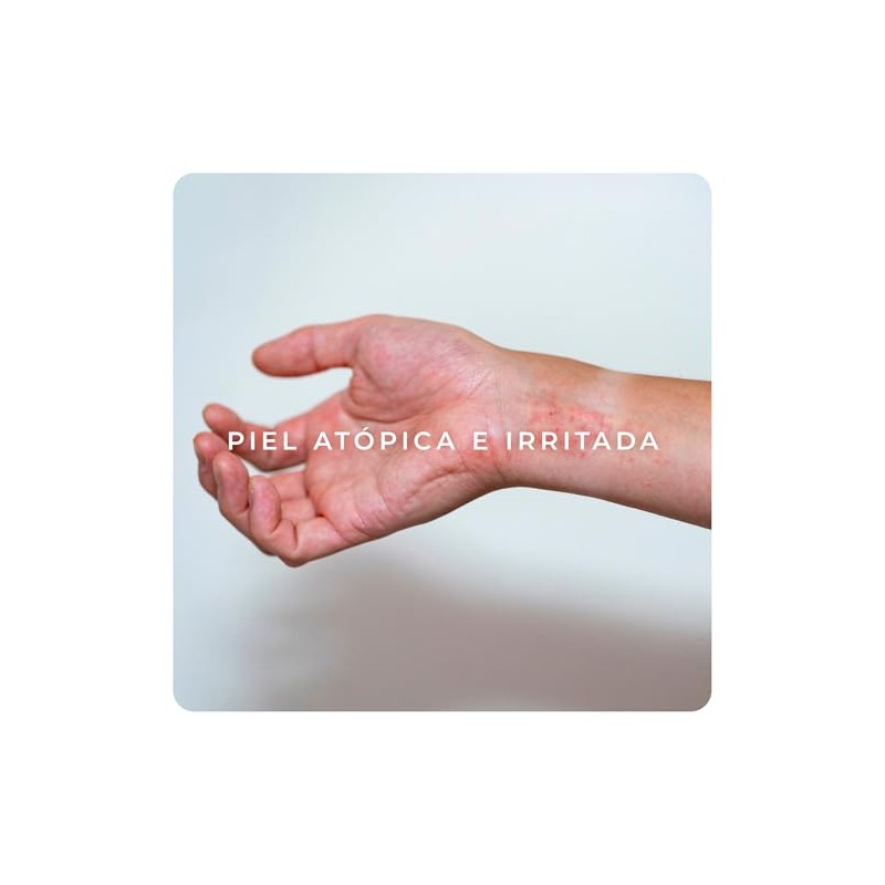 Derman Atopi Calm Crema Corporal │ Urea-D 5% + Avena